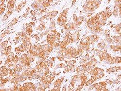 RUFY1 Polyclonal Antibody:Antibodies, Polyclonal