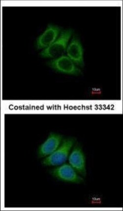 Invitrogen RUFY1 Polyclonal Antibody 100 &mu;L; Unconjugated:Antibodies,