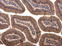 Invitrogen SPRY4 Polyclonal Antibody 100 &mu;L | Buy Online | Invitrogen&trade; | Fisher Scientific