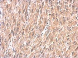Invitrogen SPRY4 Polyclonal Antibody 100 &mu;L | Buy Online | Invitrogen&trade; | Fisher Scientific
