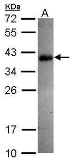 Invitrogen SPRY4 Polyclonal Antibody 100 &mu;L | Buy Online | Invitrogen&trade; | Fisher Scientific