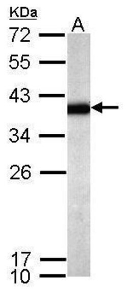 Invitrogen SPRY4 Polyclonal Antibody 100 &mu;L | Buy Online | Invitrogen&trade; | Fisher Scientific