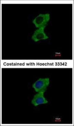 Invitrogen ZNF598 Polyclonal Antibody 100 &mu;L; Unconjugated:Antibodies,