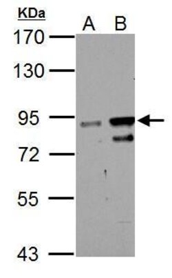 Invitrogen ZNF598 Polyclonal Antibody 100 &mu;L; Unconjugated:Antibodies,