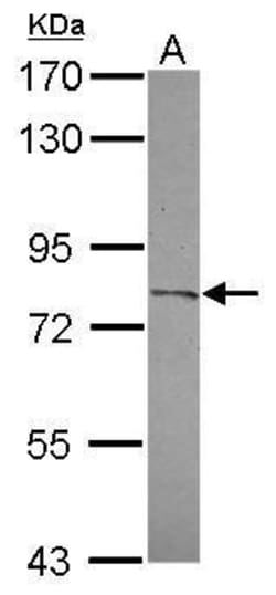 Invitrogen CPXM2 Polyclonal Antibody 100 &mu;L; Unconjugated:Antibodies,