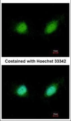 Invitrogen GABPB2 Polyclonal Antibody 100 μL; Unconjugated:Antibodies,