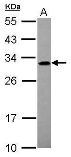 Invitrogen ADHFE1 Polyclonal Antibody 100 &mu;L; Unconjugated:Antibodies,