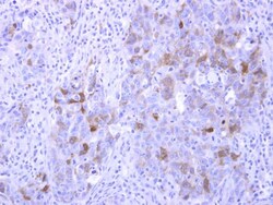 PHOSPHO1 Polyclonal Antibody, Invitrogen 100 &mu;L | Buy Online | Thermo Scientific | Fisher Scientific