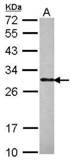 PHOSPHO1 Polyclonal Antibody, Invitrogen 100 &mu;L | Buy Online | Thermo Scientific | Fisher Scientific