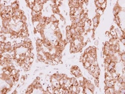 Invitrogen SDR16C5 Polyclonal Antibody 100 &mu;L; Unconjugated:Antibodies,