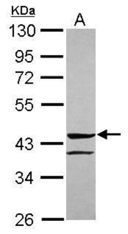 Invitrogen ANGPTL5 Polyclonal Antibody 100 &mu;L | Buy Online | Invitrogen&trade; | Fisher Scientific