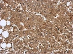 Invitrogen TRIM8 Polyclonal Antibody 100 &mu;L; Unconjugated:Antibodies,