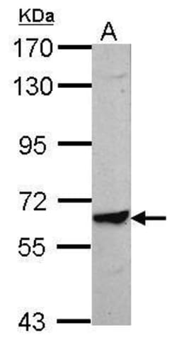 Invitrogen TRIM8 Polyclonal Antibody 100 &mu;L; Unconjugated:Antibodies,