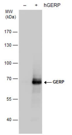 Invitrogen TRIM8 Polyclonal Antibody 100 &mu;L; Unconjugated:Antibodies,