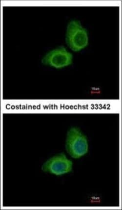 Invitrogen UBE2O Polyclonal Antibody 100 &mu;L; Unconjugated:Antibodies,