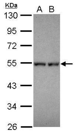 Invitrogen DPF1 Polyclonal Antibody 100 &mu;L; Unconjugated:Antibodies,