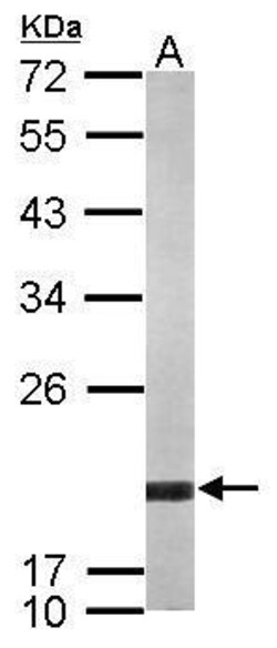 Invitrogen ARF5 Polyclonal Antibody 100 &mu;L | Buy Online | Invitrogen&trade; | Fisher Scientific