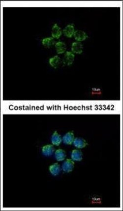 Invitrogen SERPINA4 Polyclonal Antibody 100 &mu;L; Unconjugated:Antibodies,