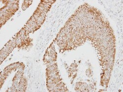 Invitrogen SERPINA4 Polyclonal Antibody 100 &mu;L; Unconjugated:Antibodies,