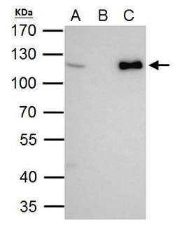 Invitrogen CHD1L Polyclonal Antibody 100 &mu;L; Unconjugated:Antibodies,
