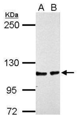 Invitrogen CHD1L Polyclonal Antibody 100 &mu;L; Unconjugated:Antibodies,