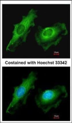 Invitrogen ITM2B Polyclonal Antibody 100 &mu;L | Buy Online | Invitrogen&trade; | Fisher Scientific