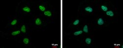 Invitrogen ZNF76 Polyclonal Antibody 100 &mu;L; Unconjugated:Antibodies,