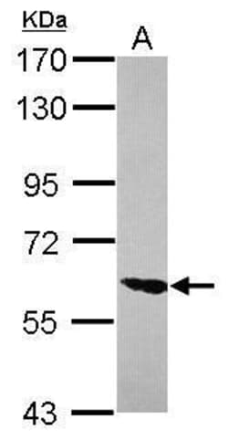 Invitrogen ZNF76 Polyclonal Antibody 100 &mu;L; Unconjugated:Antibodies,