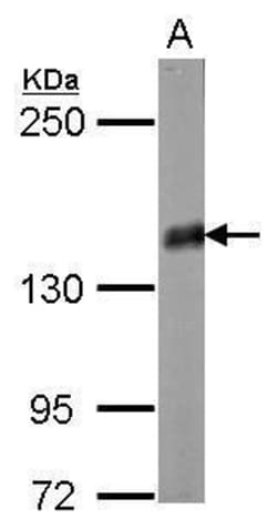 Invitrogen PPFIA2 Polyclonal Antibody 100 &mu;L; Unconjugated:Antibodies,