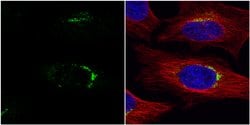 Invitrogen VPS33A Polyclonal Antibody 100 &mu;L; Unconjugated:Antibodies,