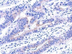 Invitrogen VPS33A Polyclonal Antibody 100 &mu;L; Unconjugated:Antibodies,