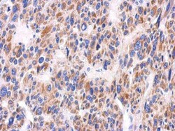 Invitrogen KIR2DS2 Polyclonal Antibody 100 &mu;L; Unconjugated:Antibodies,