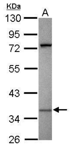 Invitrogen KIR2DS2 Polyclonal Antibody 100 &mu;L; Unconjugated:Antibodies,