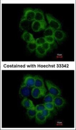 Invitrogen KIR2DS2 Polyclonal Antibody 100 &mu;L; Unconjugated:Antibodies,