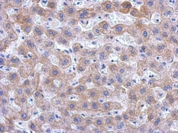 Invitrogen KIR2DS2 Polyclonal Antibody 100 &mu;L; Unconjugated:Antibodies,