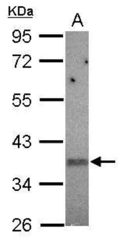 Invitrogen KIR2DS2 Polyclonal Antibody 100 &mu;L; Unconjugated:Antibodies,