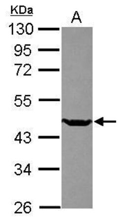 Invitrogen SETD8 Polyclonal Antibody 100 &mu;L | Buy Online | Invitrogen&trade; | Fisher Scientific