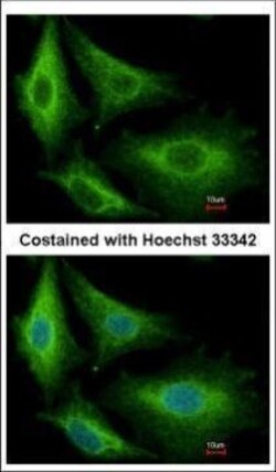 Invitrogen GSTK1 Polyclonal Antibody 100 μL; Unconjugated:Antibodies,