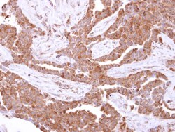 Invitrogen GSTK1 Polyclonal Antibody 100 &mu;L; Unconjugated:Antibodies,