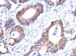 Invitrogen GSTK1 Polyclonal Antibody 100 &mu;L; Unconjugated:Antibodies,
