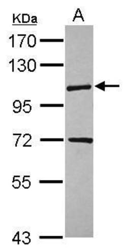 Invitrogen KIF18A Polyclonal Antibody 100 &mu;L; Unconjugated:Antibodies,