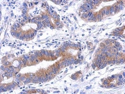 Invitrogen Annexin A8 Polyclonal Antibody 100 &mu;L; Unconjugated:Antibodies,