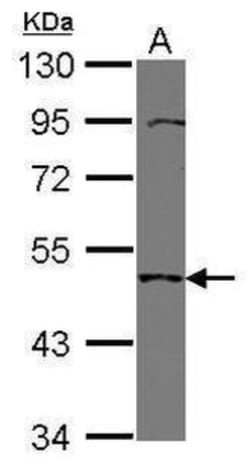 Invitrogen TMPRSS11B Polyclonal Antibody 100 &mu;L | Buy Online | Invitrogen&trade; | Fisher Scientific