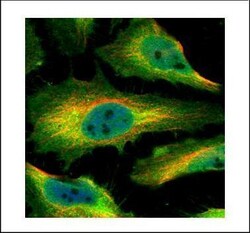 Invitrogen SMYD1 Polyclonal Antibody 100 &mu;L; Unconjugated:Antibodies,