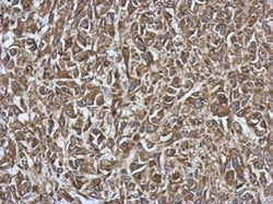 Invitrogen SMYD1 Polyclonal Antibody 100 &mu;L; Unconjugated:Antibodies,