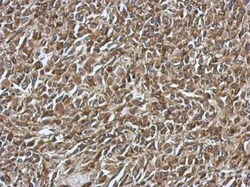 Invitrogen SMYD1 Polyclonal Antibody 100 &mu;L; Unconjugated:Antibodies,