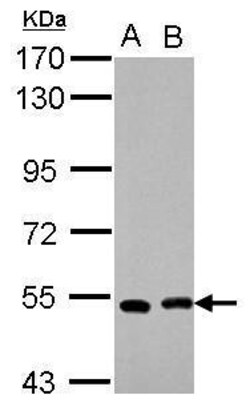 Invitrogen SMYD1 Polyclonal Antibody 100 &mu;L; Unconjugated:Antibodies,