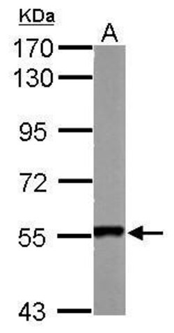 Invitrogen SMYD1 Polyclonal Antibody 100 &mu;L; Unconjugated:Antibodies,