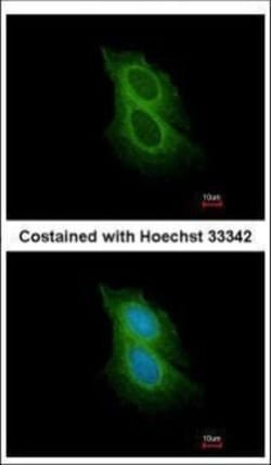 Invitrogen Spinesin Polyclonal Antibody 100 &mu;L | Buy Online | Invitrogen&trade; | Fisher Scientific