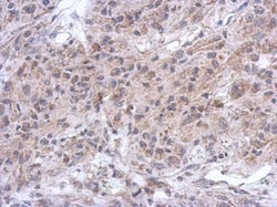 Invitrogen Spinesin Polyclonal Antibody 100 &mu;L | Buy Online | Invitrogen&trade; | Fisher Scientific